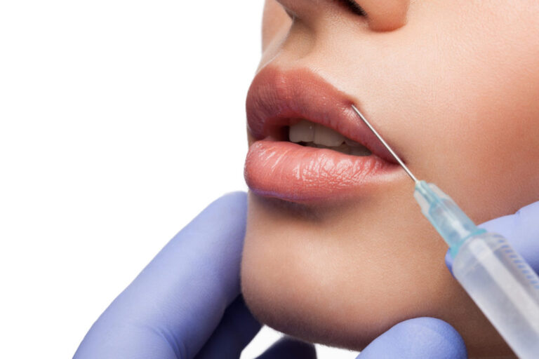 Anti Aging Filler Hyaluron