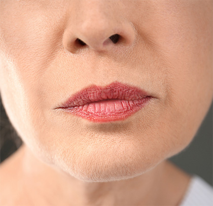 Anti Aging im Gesichtsbereich